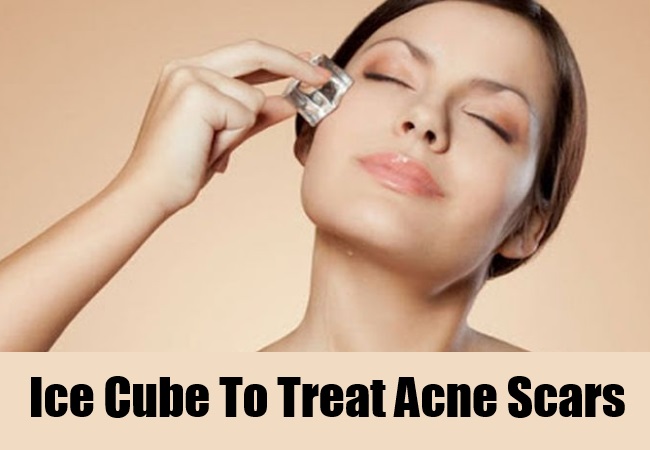 Ice-Cube-To-Treat-Acne-Scars