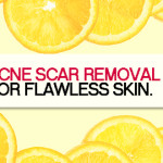 How to Get Rid of Acne Scars