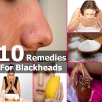 How to Get Rid of Blackheads