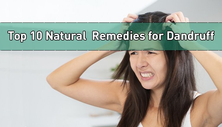 Top 10 Home Remedies to Get Rid of Dandruff - Beauty and Blush