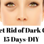 How to Get Rid of Dark Circles in 15 Days-DIY