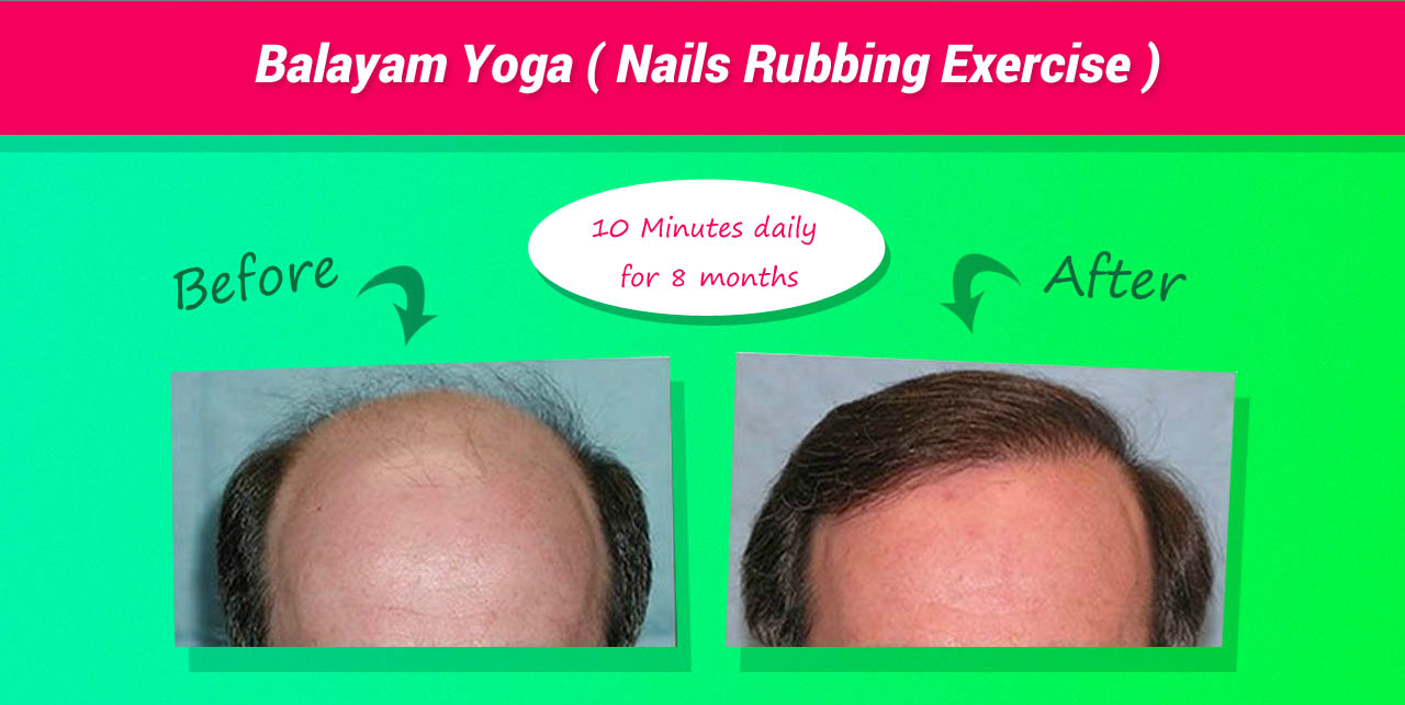 Get Rid of Hair Fall with this Simple Indian Yoga Practice - Beauty and  Blush