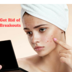 How to Get Rid of Sudden Breakouts