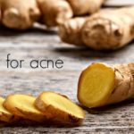 How to Use Ginger for Treating Acne Naturally
