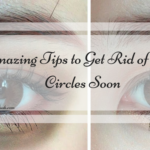 Amazing Tips to Get Rid of Dark Circles Soon