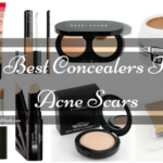 5 Best Concealers For Acne Scars