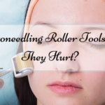 Microneedling Roller Tools: Do They Hurt?
