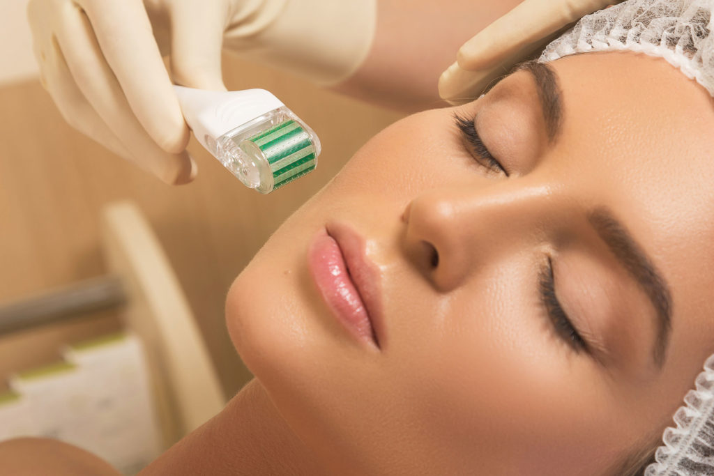 Microneedling Roller Tools: Do They Hurt?