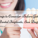 Things to Consider Before Getting Dental Implants, San Diego