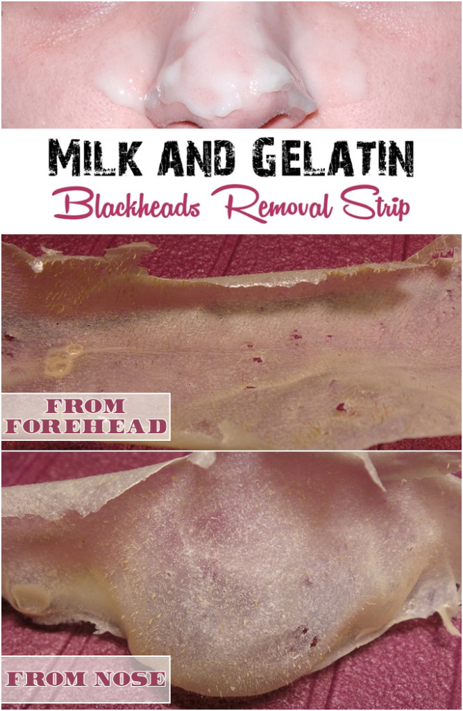 Gelatin-blackheads-removal