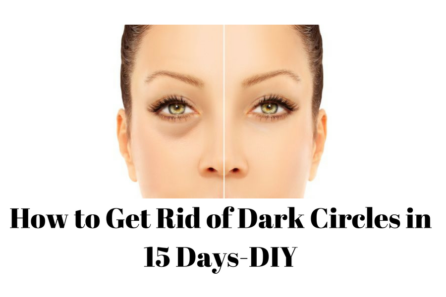 how to get rid of dark circles naturally in 3 days