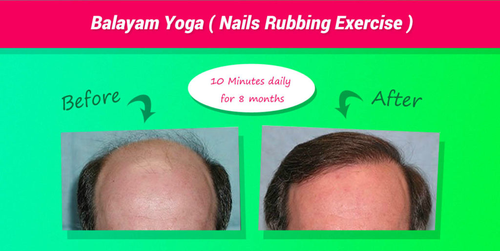 Get Rid of Hair Fall with this Simple Indian Yoga Practice