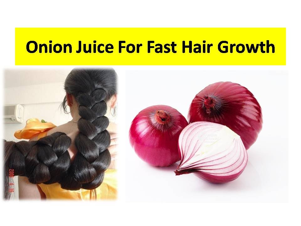 Onion for Hair Loss, Hair Thinning and Hair Re-Growth ...
