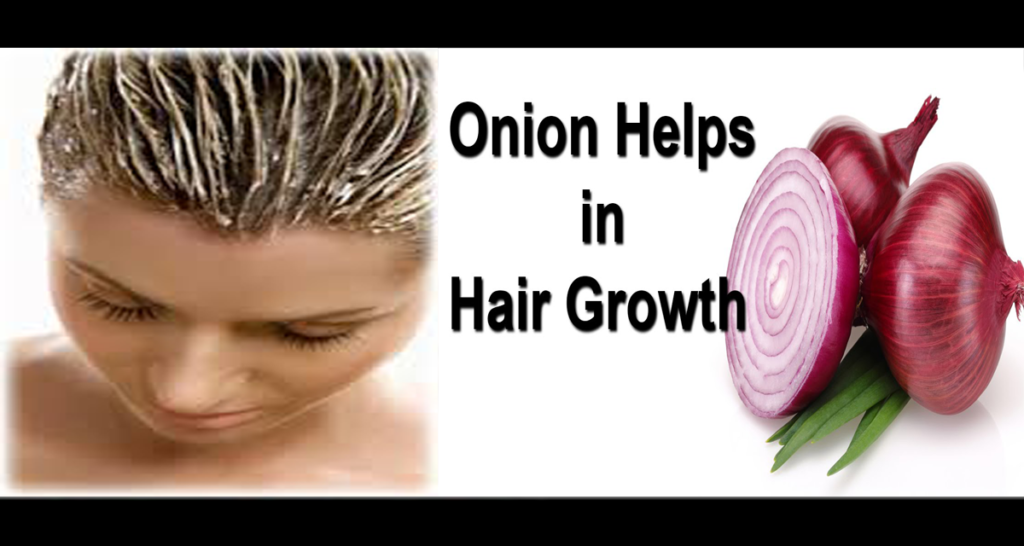 Onion for Hair Loss, Hair Thinning and Hair Re-Growth