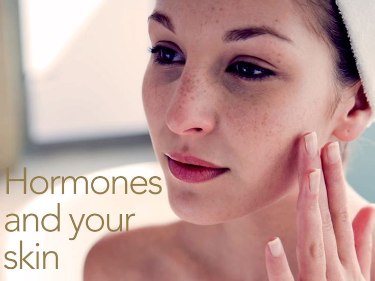  Are Your Hormones Playing Havoc with Your Skin?