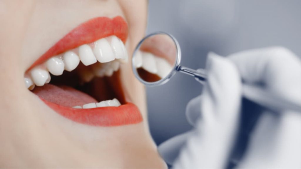 Whitening Options For Different Oral Situations