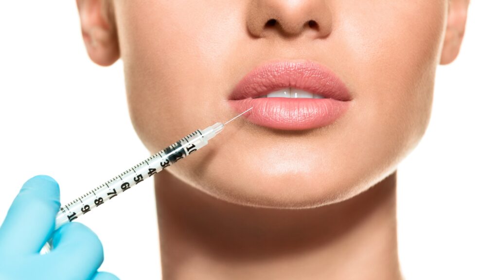 6 Things You Need to Know Before Getting Lip Filler