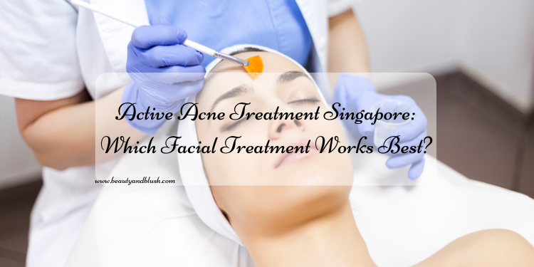 Active Acne Treatment Singapore: Which Facial Treatment Works Best? - Beauty And Blush